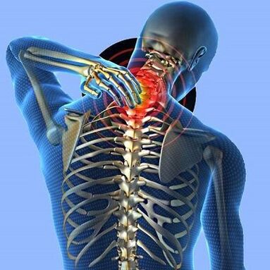 бол у врату са цервикалном остеохондрозом
