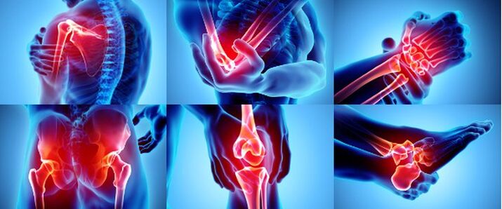 Упаљени зглобови